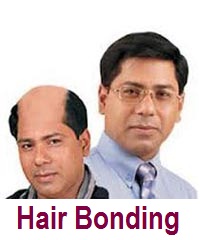 hair-bonding-1