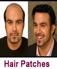 hair-pathces