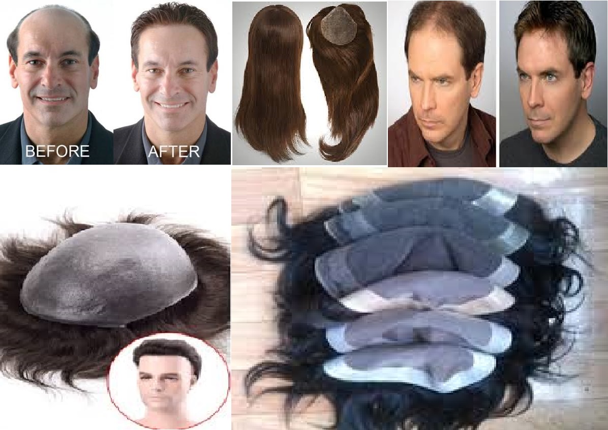 Mohan Hair 8130039632 | Hair Bonding Laxmi Nagar Delhi | Hair weaving Mohan Hair 8130039632 | Hair Bonding Laxmi Nagar Delhi | Hair weaving